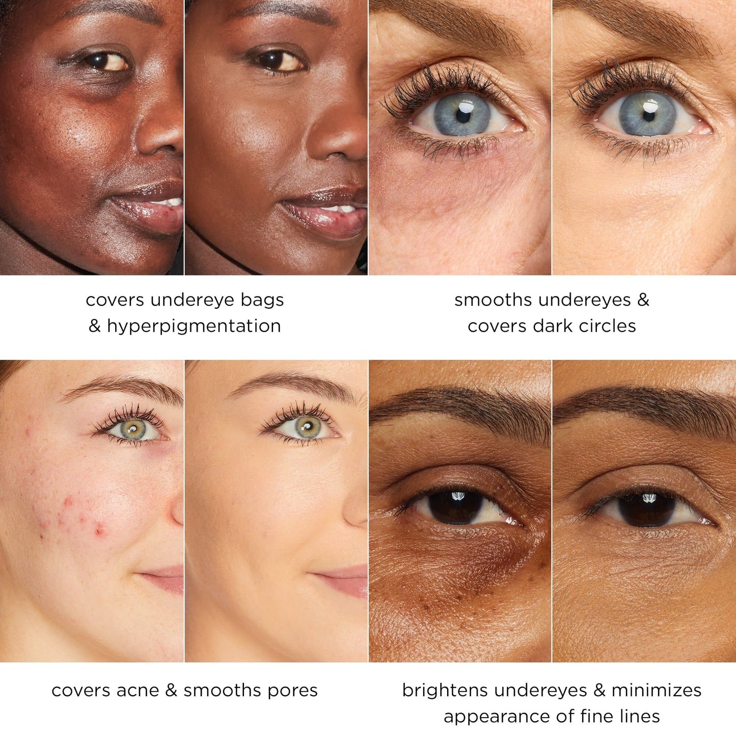 Blur Concealer Stick SPF 30 - instantly brightens, hydrates & smooths your skin