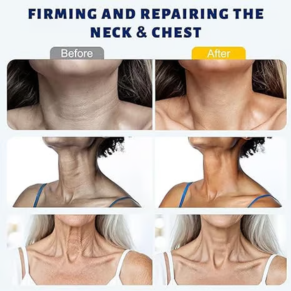 Roller Massage Neck Cream 🧴 Collagen & Hyaluronic Acid | Firms Neck, Reduces Wrinkles & Double Chin
