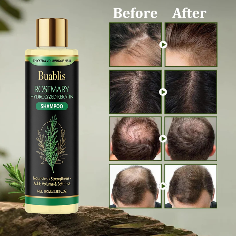 🌱 Buablis® Organic Rosemary Hair Growth Shampoo,Fast Hair Growth, Anti Hair Loss, Deep Damage Repair with Smoothing, Oil Control & Dandruff Care✅