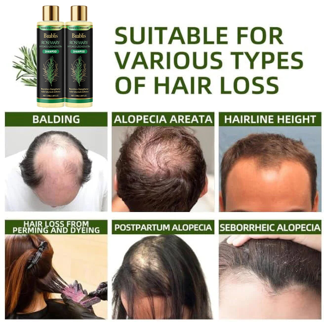 🌱 Buablis® Organic Rosemary Hair Growth Shampoo,Fast Hair Growth, Anti Hair Loss, Deep Damage Repair with Smoothing, Oil Control & Dandruff Care✅