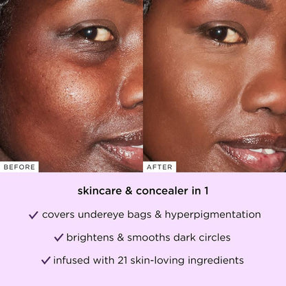 Blur Concealer Stick SPF 30 - instantly brightens, hydrates & smooths your skin